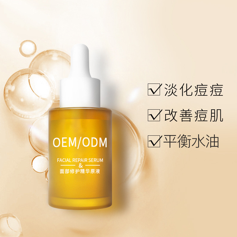 济南市_祛痘精华原液OEM